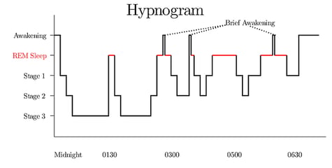 Sleep architecture and why exercise timing matters more than you think